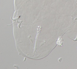 Macrobiotus spectabilis image