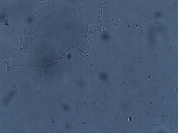 Macrobiotus spectabilis image