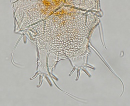 Echiniscus quadrispinosus image