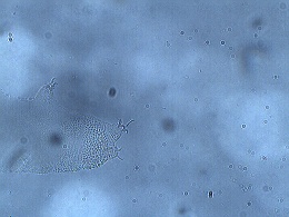 Pilatobius nodulosus image