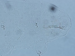 Adorybiotus granulatus image