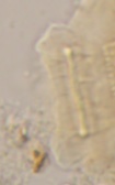 Paramacrobiotus tonollii image