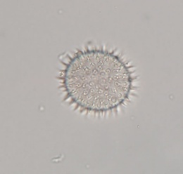 Mesobiotus furciger image
