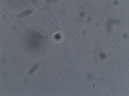 Isohypsibius marcellinoi image