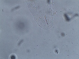 Isohypsibius canadensis image