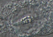 Pilatobius oculatus alpinus image