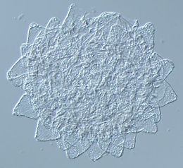 Image of Paramacrobiotus richtersi
