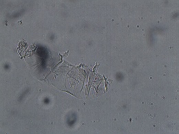 Minibiotus acontistus image