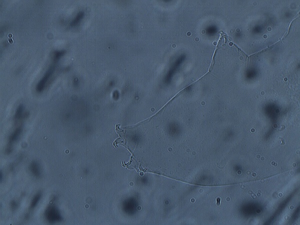 Macrobiotus grandis image