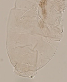Macrobiotus occidentalis image