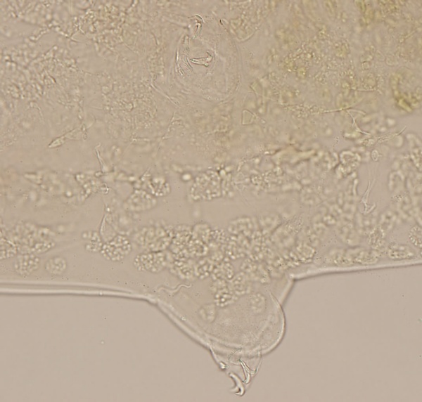 Adorybiotus image
