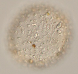 Macrobiotus hibiscus image