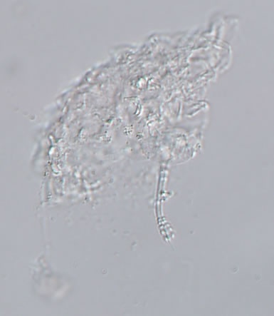 Isohypsibius brevispinosus image
