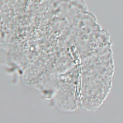 Image of Isohypsibius brevispinosus