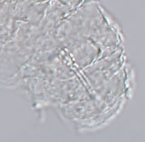 Isohypsibius brevispinosus image