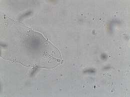 Mesobiotus montanus image