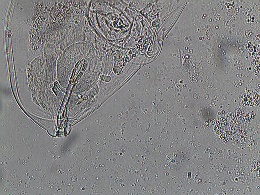 Image of Macrobiotus ovidii