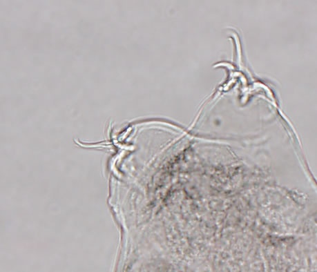Hypsibiidae image