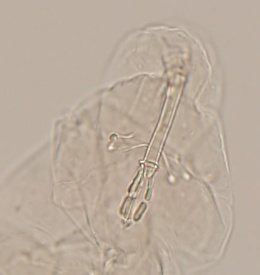 Macrobiotus occidentalis image