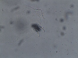 Macrobiotus islandicus image