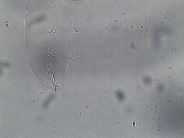 Image of Mesobiotus mauccii
