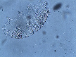 Image of Echiniscus columinis