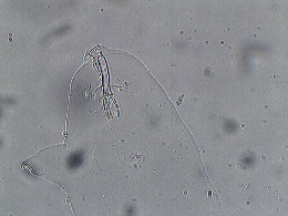 Mesobiotus mauccii image