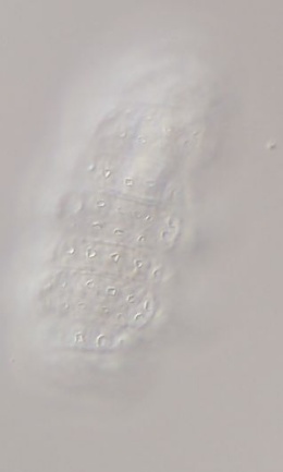 Image of Minibiotus pustulatus