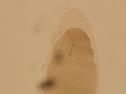 Macrobiotus pallarii image