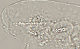 Diphascon alpinum image