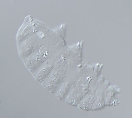 Minibiotus pustulatus image