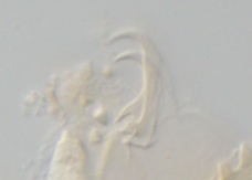 Echiniscus mediantus image
