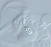 Minibiotus subintermedius image
