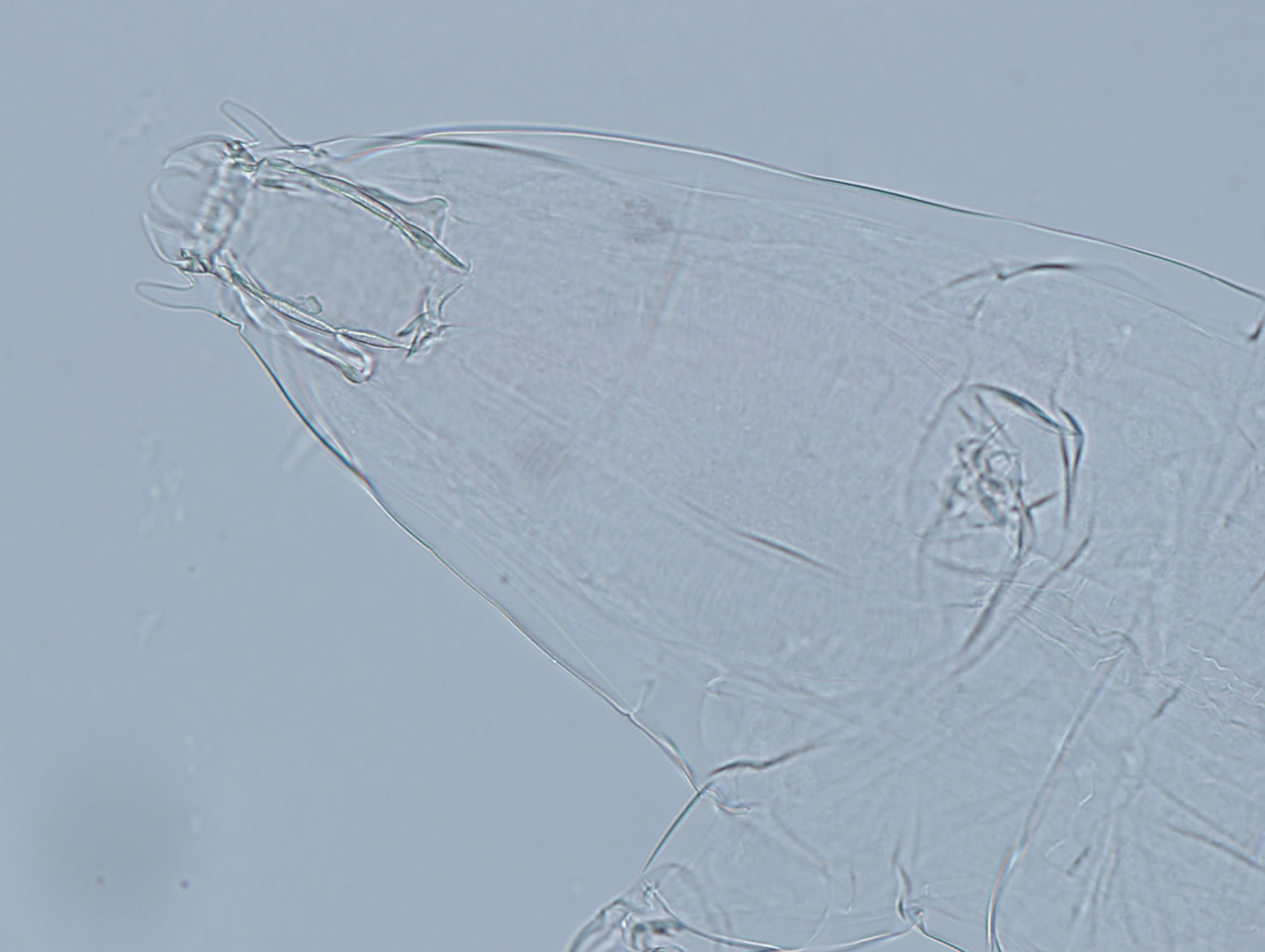 Image of Milnesium eurystomum