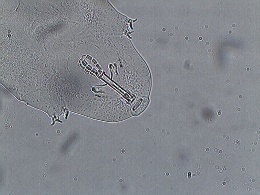 Mesobiotus montanus image