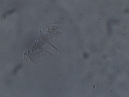 Minibiotus acontistus image