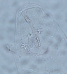 Image of Macrobiotus crenulatus