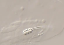 Image of Minibiotus subintermedius
