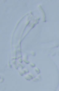 Paramacrobiotus richtersi image