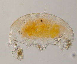 Echiniscus canadensis image