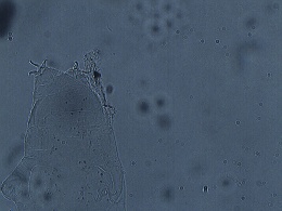 Isohypsibius prosostomus image