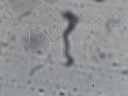 Isohypsibius deflexus image