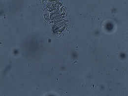 Isohypsibius prosostomus image