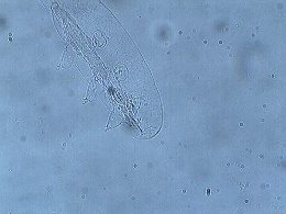 Diphascon stappersi image